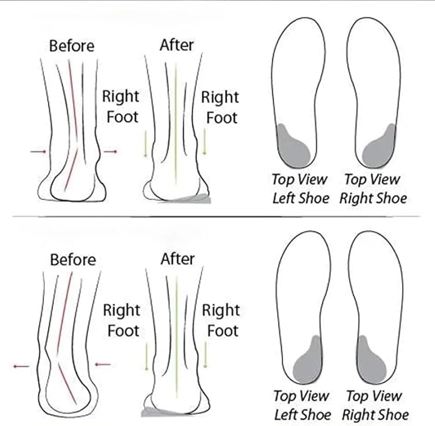 Women's Soft Sole Mesh Comfort Orthopedic Shoes, Women's Casual Lightweight Soft Sole Mesh Comfort Orthopedic Shoes